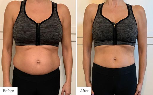 5 - Before and After Real Results image of a woman that has used the NeoraFit™ New Year Reset Program.