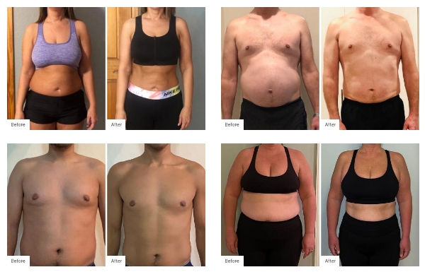 Before and After Real Result images of people that have used the NeoraFit™ + Protein Powder Starter Set.